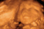 birth announcement of Baby Brooklynne Virginia